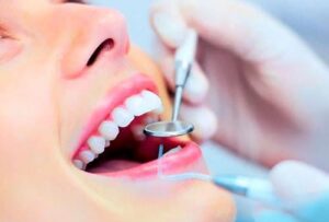 restauración en todos los dientes